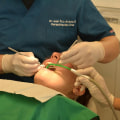 Ensuring Safety with CT Guided Dental Implants in North Little Rock